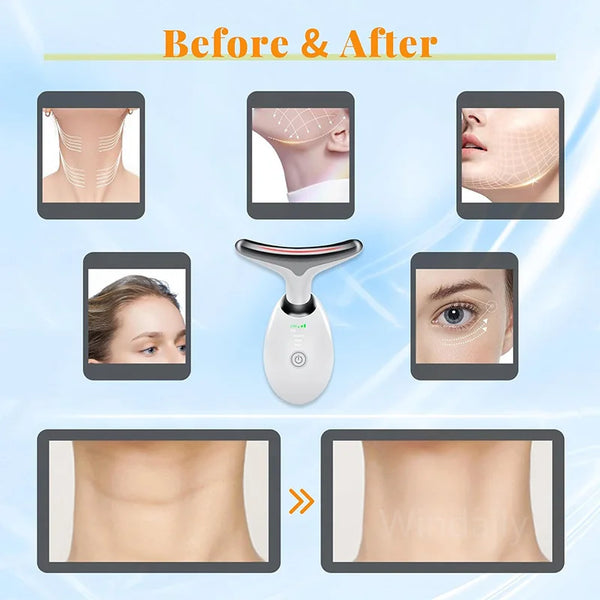 Anti Wrinkle Facial Massager