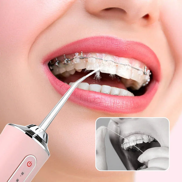 Portable Water Flosser USB Rechargeable – Dental Oral Irrigator for Deep Teeth Cleaning, 4 Tips, 220ml Tank