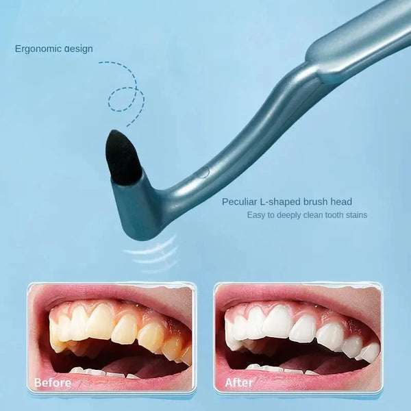 Manual Teeth Plaque Remover – Deep Cleaning Stain Removal Tool