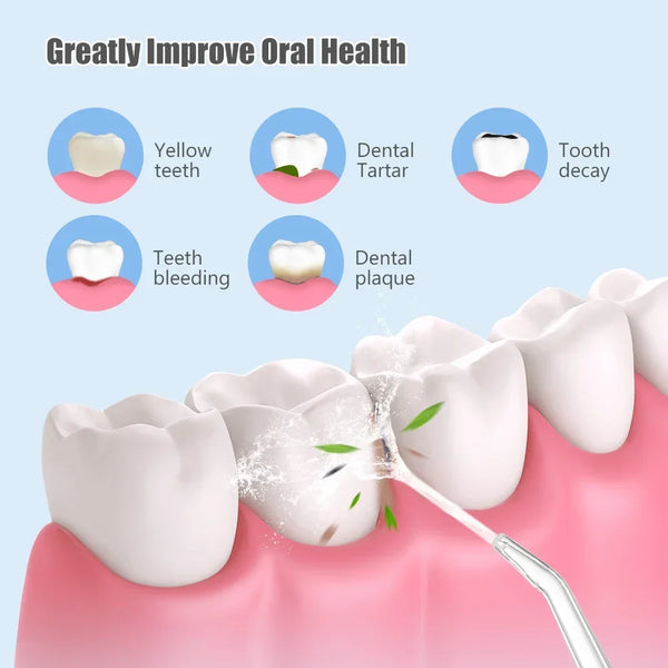 Portable Water Flosser USB Rechargeable – Dental Oral Irrigator for Deep Teeth Cleaning, 4 Tips, 220ml Tank